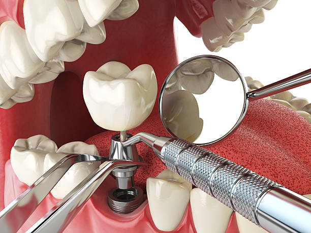 Best Emergency Dental Care for Broken or Chipped Teeth in Whitaker, PA